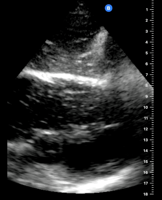 EEU case image missing